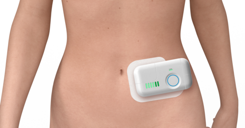 Wearables_ Large Volume Injector on abdomen.png